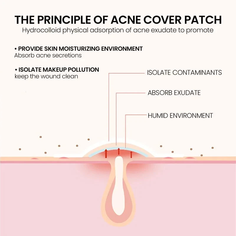 Invisible Star Pimple Patches