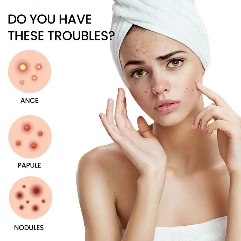Invisible Star Pimple Patches