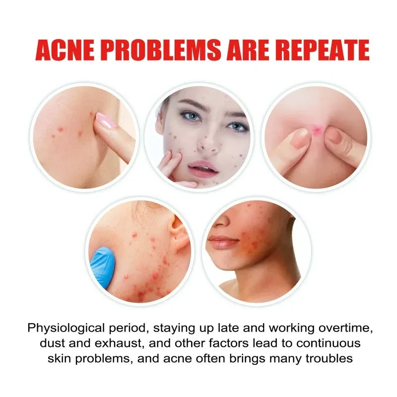 Invisible Star Pimple Patches